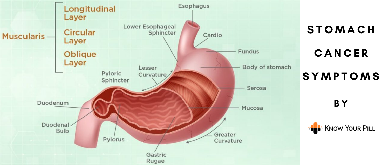 Stomach Cancer Symptoms