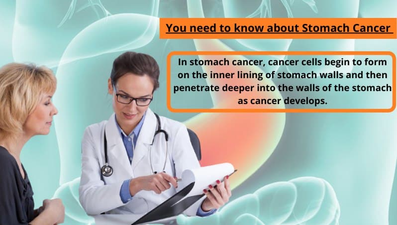 What You Need to Know About Stomach Cancer